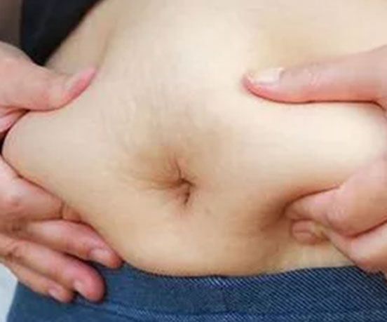 Belly fat on sale