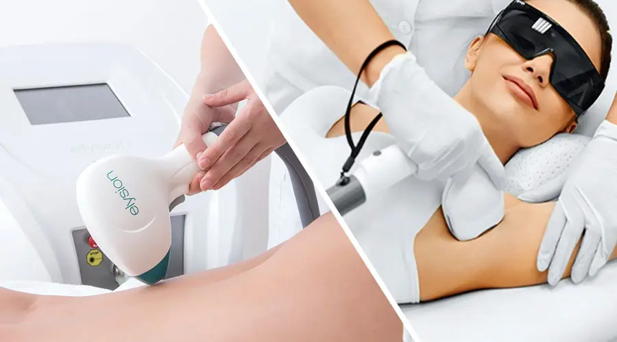 Laser Vs IPL Hair Removal