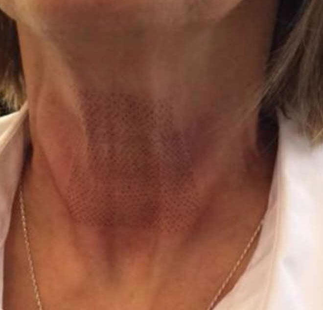 Before & After Treatment after image