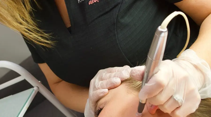 Treatment of the Month January: Microneedling