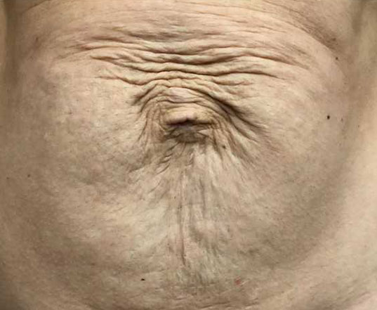 Before & After Treatment before image