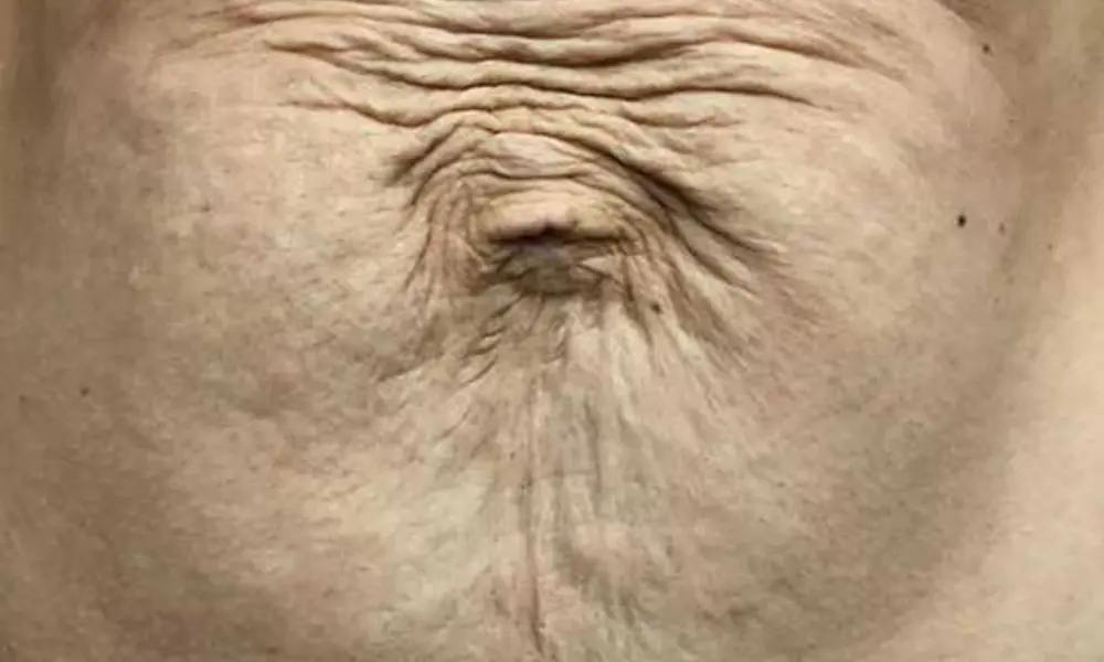 Before & After Treatment before image