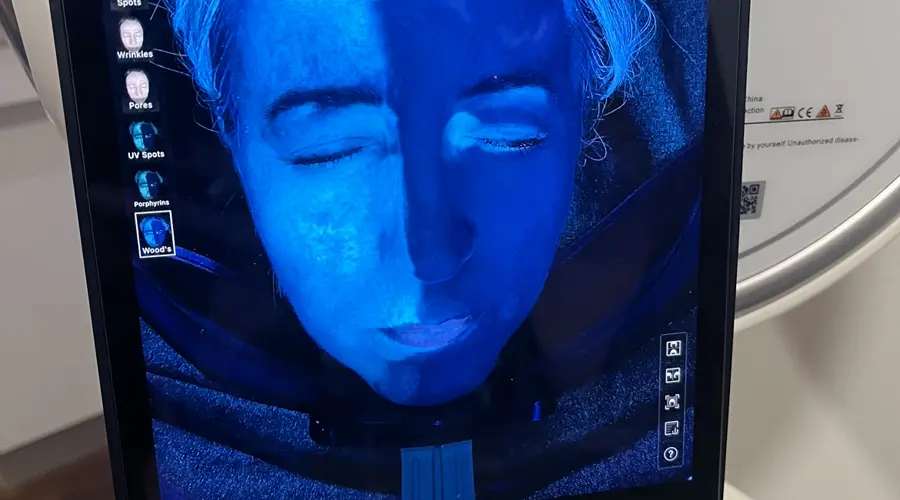 Unveiling the Invisible Foe in Skincare: Blue Light Radiation