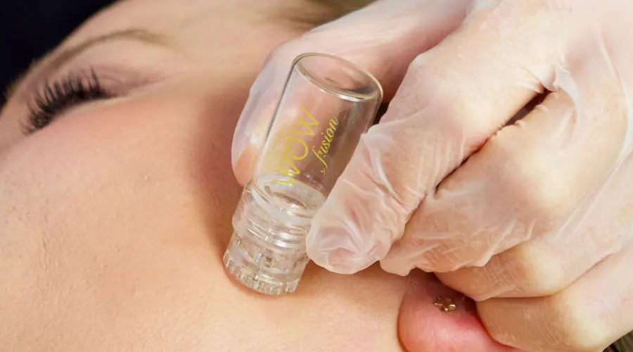 Treatment of the Month - WOW Fusion (Mini WOW Facial)