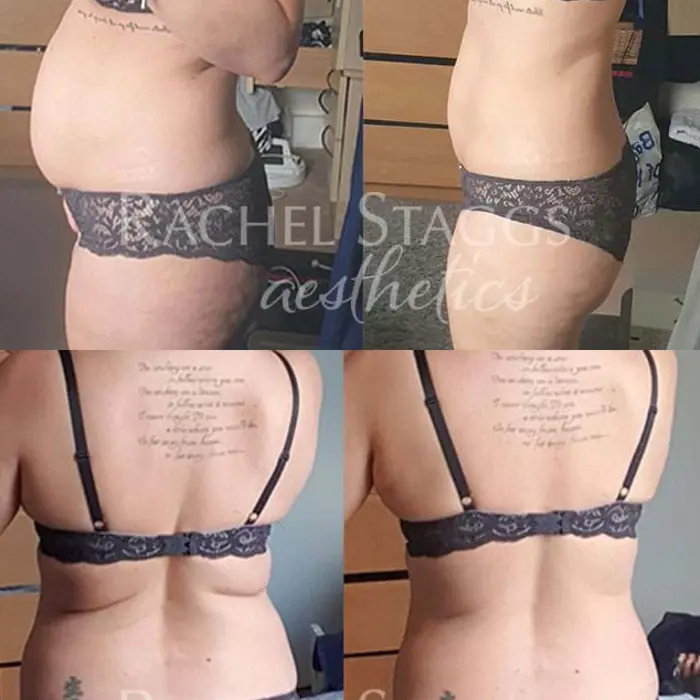 Supernova/5 Day Detox Benefits Rachel Staggs Aesthetics