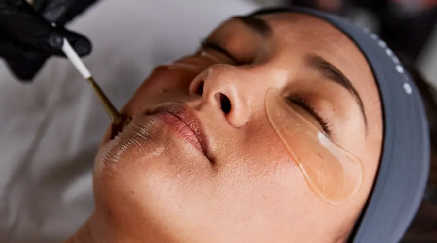 Discover the benefits of a chemical peel