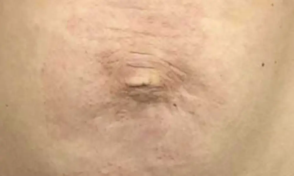 Before & After Treatment after image