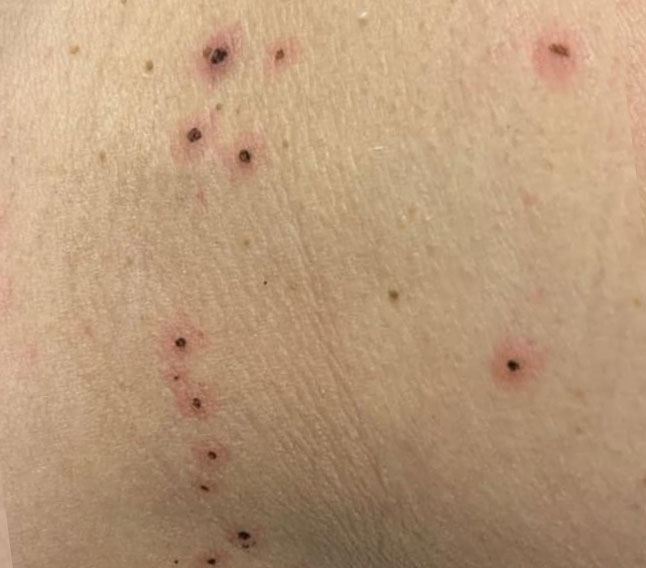 Before & After Treatment after image